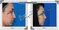 عمل بینی شماره 502