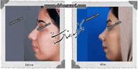 عمل بینی شماره 504