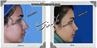 عمل بینی شماره 508