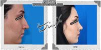 عمل بینی شماره 510