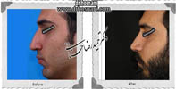 عمل بینی شماره 512