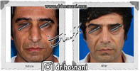  جراحی بینی -523