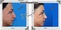 عمل بینی شماره 528