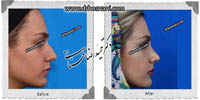 عمل بینی شماره 534