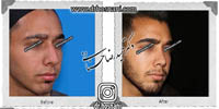 عمل بینی شماره 539
