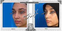عمل بینی شماره 541