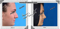 عمل بینی شماره 556