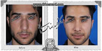 عمل بینی شماره 559