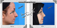 عمل بینی شماره 562