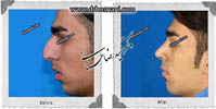 عمل بینی شماره 564