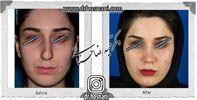 عمل بینی شماره 565