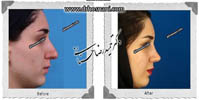 عمل بینی شماره 566