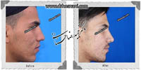 عمل بینی شماره 568