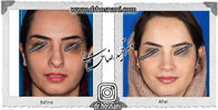 عمل بینی شماره 569