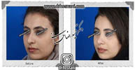 عمل بینی شماره 571