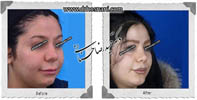 عمل بینی شماره 579