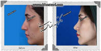 عمل بینی شماره 583