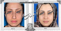 عمل بینی شماره 584