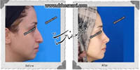 عمل بینی شماره 585