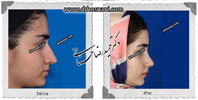 عمل بینی شماره 587