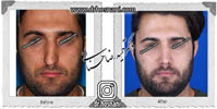 عمل بینی شماره 588