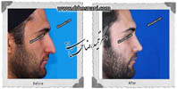 عمل بینی شماره 589