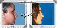 عمل بینی شماره 593