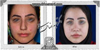 عمل بینی شماره 599