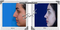 عمل بینی شماره 600