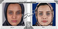 عمل بینی شماره 601