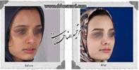 عمل بینی شماره 602