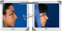 عمل بینی شماره 604