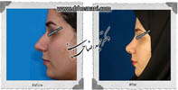 عمل بینی شماره 606