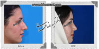 عمل بینی شماره 616