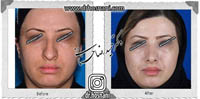 عمل بینی شماره 618