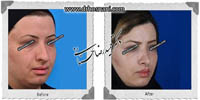 عمل بینی شماره 619