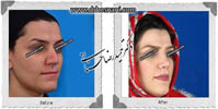 عمل بینی شماره 621