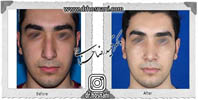 عمل بینی شماره 622