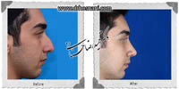 عمل بینی شماره 623