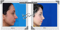 عمل بینی شماره 625