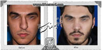 عمل بینی شماره 626