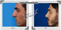 عمل بینی شماره 627