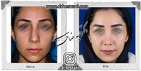 عمل بینی شماره 635