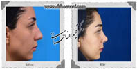 عمل بینی شماره 636