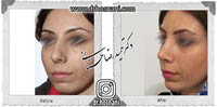 عمل بینی شماره 641