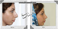 عمل بینی شماره 642