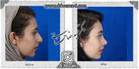 عمل بینی شماره 645