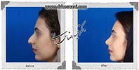 عمل بینی شماره 646