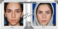 عمل بینی شماره 647