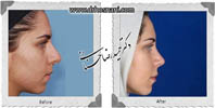 عمل بینی شماره 648